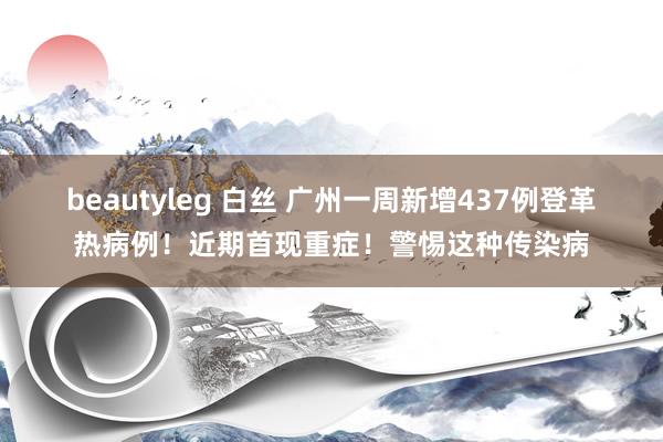 beautyleg 白丝 广州一周新增437例登革热病例！近期首现重症！警惕这种传染病